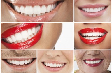 wybielanie zębów - białe zęby